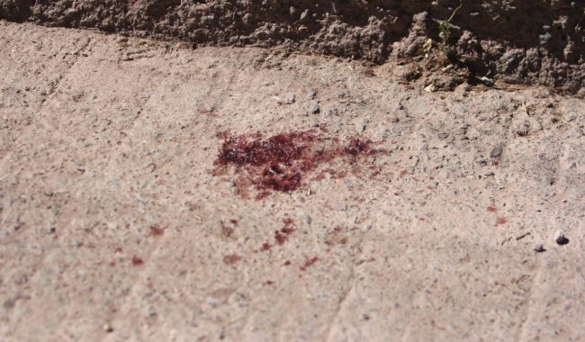 Hieren con arma de fuego a un hombre en el centro de Ojocaliente