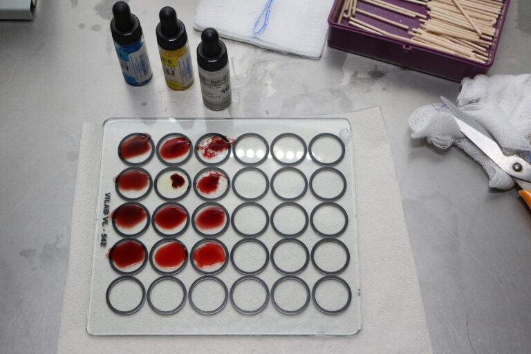 Conmemoran Día Mundial de la Hemofilia