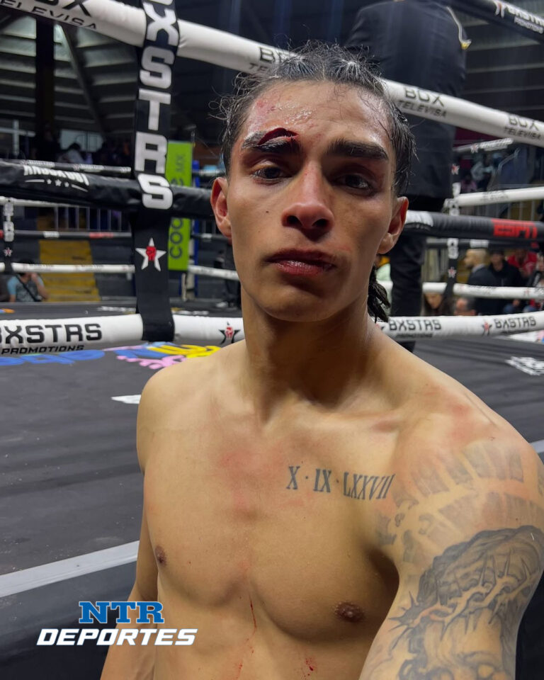 Frezzer Hernández empata en su pelea por cabezazo
