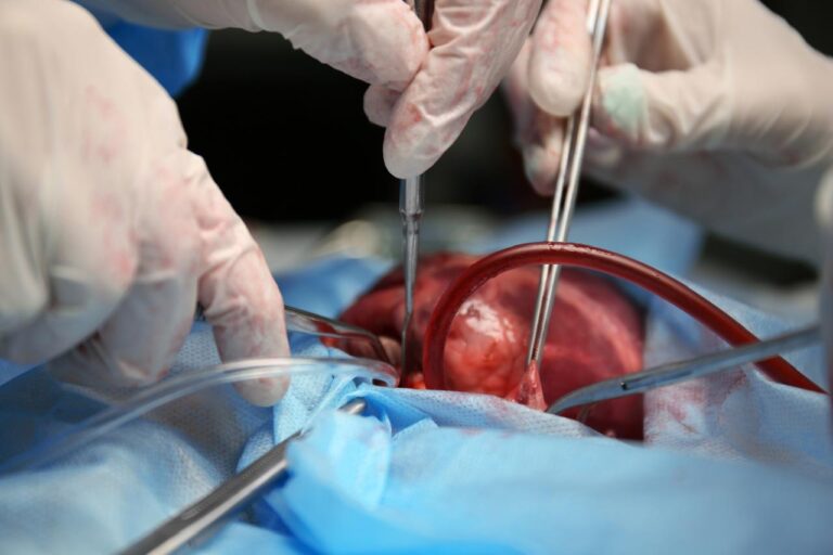 Procuran tres donaciones de órganos en las últimas 48 horas