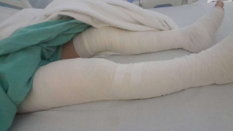 Piden ayuda para tratamiento médico de Yazmín Victoria